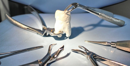 Удаление зубов сургут